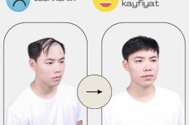 Erkaklar uchun parik, Мужской протез волос, парик